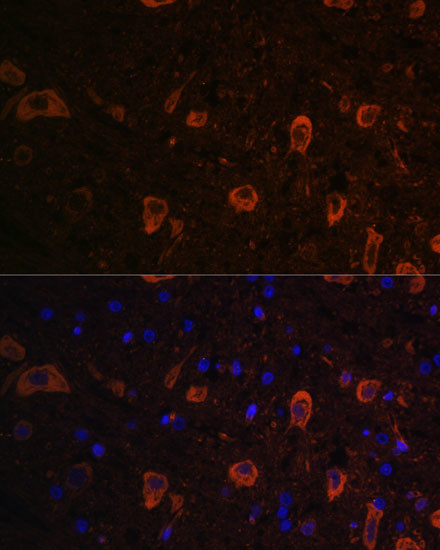 LC3B Antibody in Immunohistochemistry (Paraffin) (IHC (P))