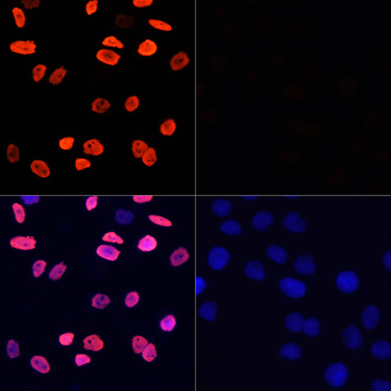 H3K9ac Antibody in Immunocytochemistry (ICC/IF)