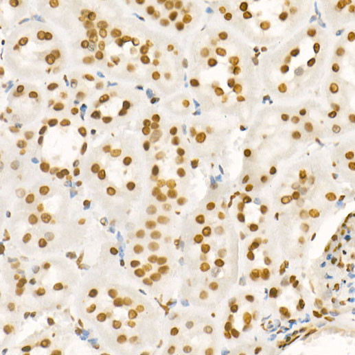 H4K8ac Antibody in Immunohistochemistry (Paraffin) (IHC (P))