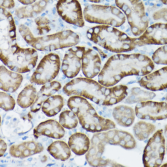 SIRT3 Antibody in Immunohistochemistry (Paraffin) (IHC (P))