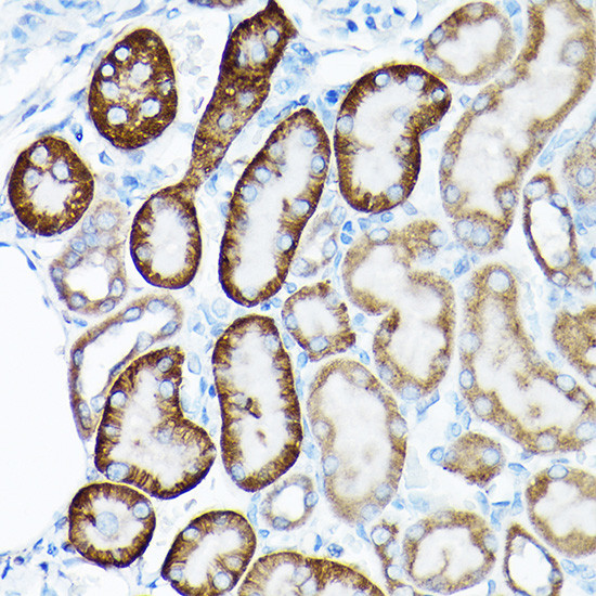 SIRT3 Antibody in Immunohistochemistry (Paraffin) (IHC (P))