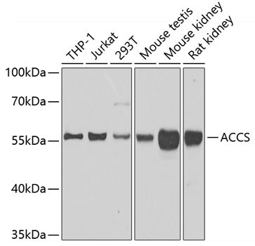 ACCS Antibody in Western Blot (WB)