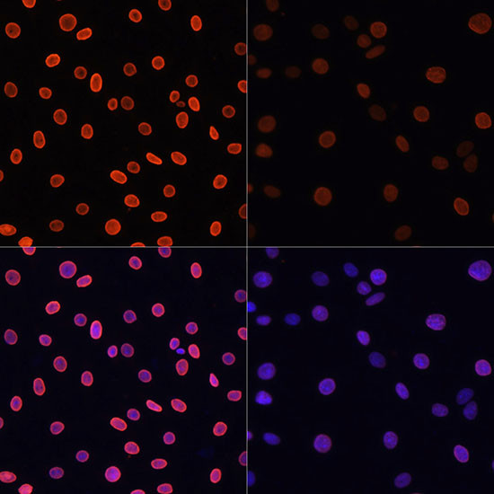 H4K91ac Antibody in Immunocytochemistry (ICC/IF)