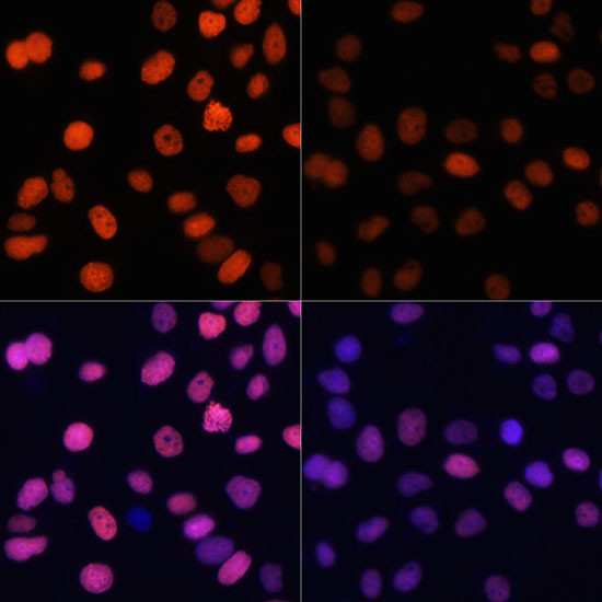 H4K91ac Antibody in Immunocytochemistry (ICC/IF)