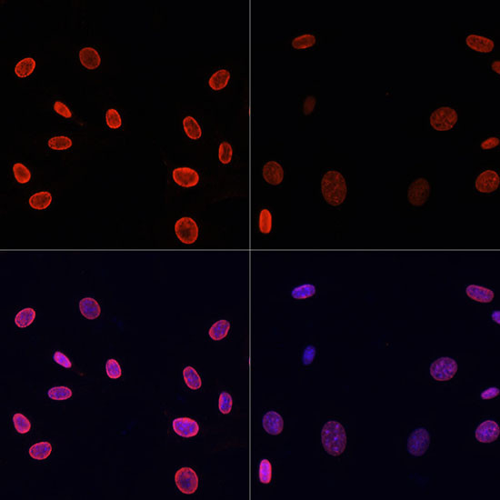 H4K91ac Antibody in Immunocytochemistry (ICC/IF)