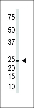 IL-29 Antibody in Western Blot (WB)