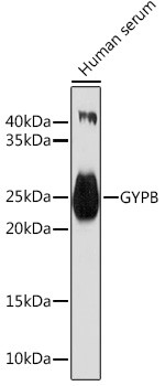 GYPB Antibody in Western Blot (WB)