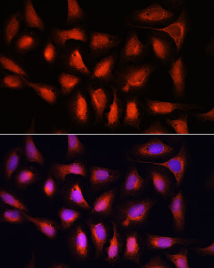 IRF1 Antibody in Immunocytochemistry (ICC/IF)