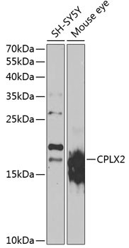 CPLX2 Antibody in Western Blot (WB)