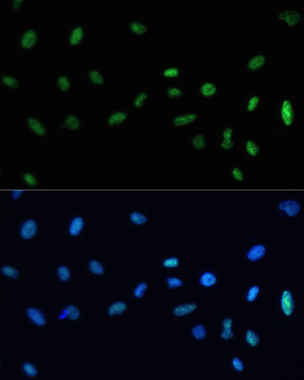 SAFB Antibody in Immunocytochemistry (ICC/IF)