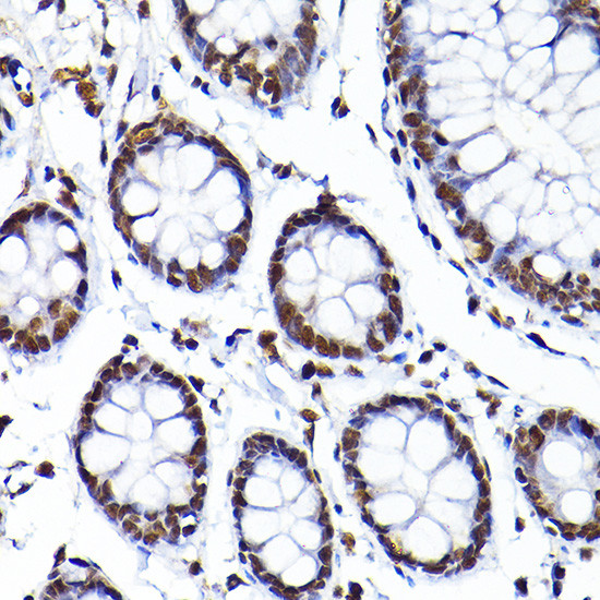 SAFB Antibody in Immunohistochemistry (Paraffin) (IHC (P))