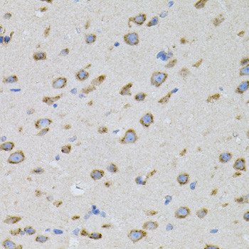 SNAP alpha Antibody in Immunohistochemistry (Paraffin) (IHC (P))