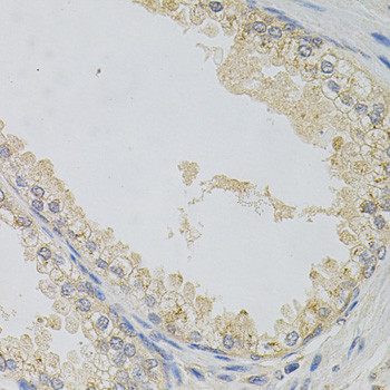 SNAP alpha Antibody in Immunohistochemistry (Paraffin) (IHC (P))