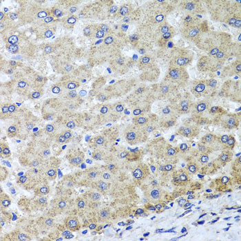 OSGEPL1 Antibody in Immunohistochemistry (Paraffin) (IHC (P))