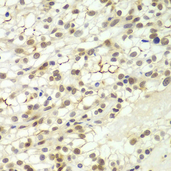 LHX4 Antibody in Immunohistochemistry (Paraffin) (IHC (P))