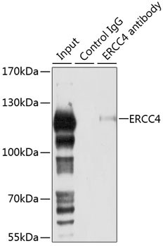 XPF Antibody in Immunoprecipitation (IP)