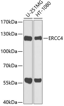 XPF Antibody in Western Blot (WB)