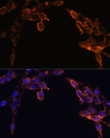 Cytochrome P450 Reductase Antibody in Immunocytochemistry (ICC/IF)