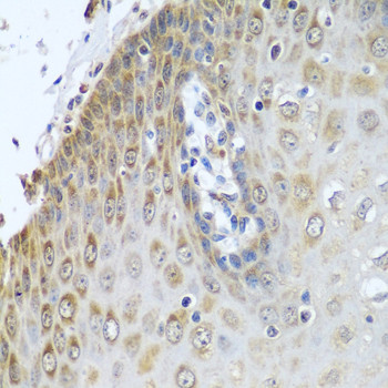 Cytochrome P450 Reductase Antibody in Immunohistochemistry (Paraffin) (IHC (P))