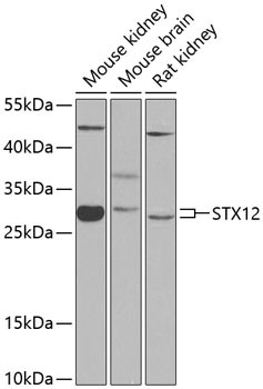 STX12 Antibody in Western Blot (WB)