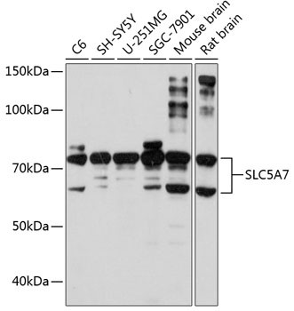 SLC5A7 Antibody in Western Blot (WB)