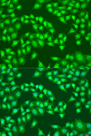 Viperin Antibody in Immunocytochemistry (ICC/IF)