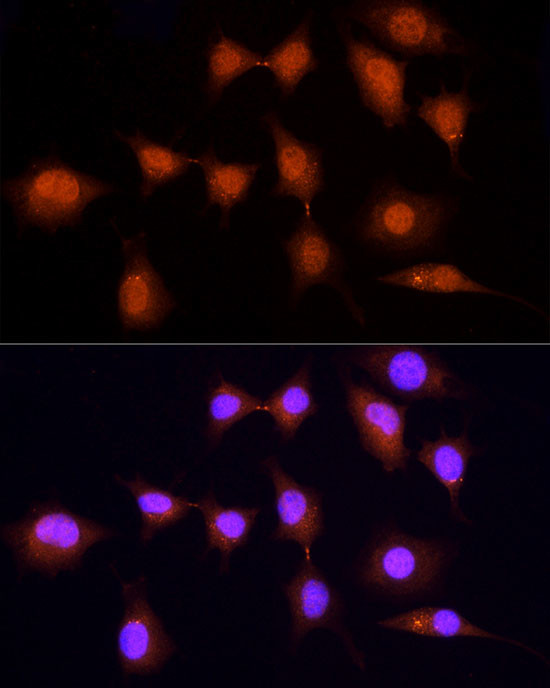 KPNA3 Antibody in Immunocytochemistry (ICC/IF)