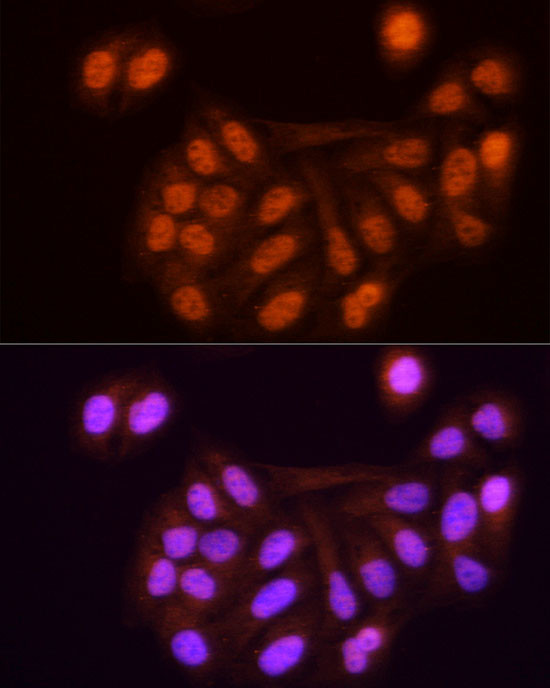 KPNA3 Antibody in Immunocytochemistry (ICC/IF)