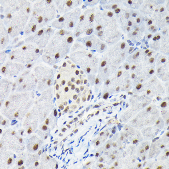 KPNA3 Antibody in Immunohistochemistry (Paraffin) (IHC (P))