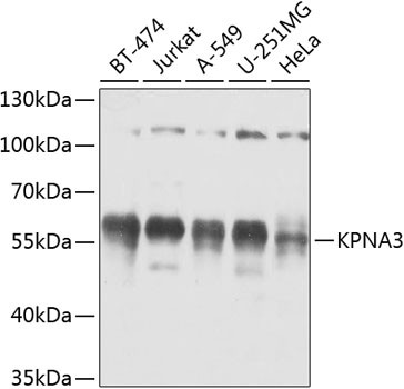 KPNA3 Antibody in Western Blot (WB)