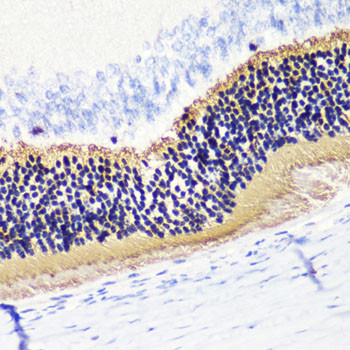 PDC Antibody in Immunohistochemistry (Paraffin) (IHC (P))