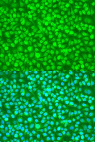 N4BP1 Antibody in Immunocytochemistry (ICC/IF)