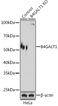 B4GALT1 Antibody in Western Blot (WB)