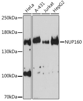 NUP160 Antibody in Western Blot (WB)