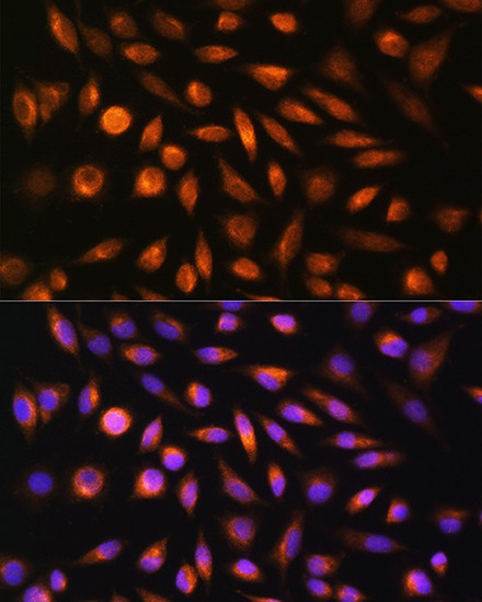 SH3PXD2A Antibody in Immunocytochemistry (ICC/IF)