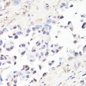 Phospho-c-Myc (Thr58) Antibody in Immunohistochemistry (Paraffin) (IHC (P))