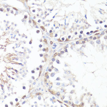 Phospho-c-Myc (Thr58) Antibody in Immunohistochemistry (Paraffin) (IHC (P))