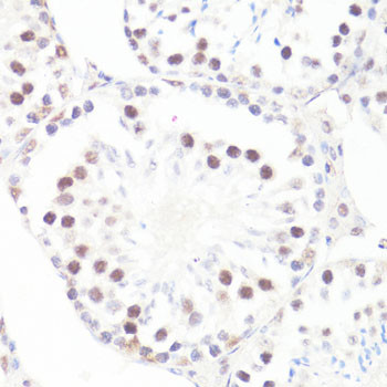 Phospho-c-Myc (Ser62) Antibody in Immunohistochemistry (Paraffin) (IHC (P))