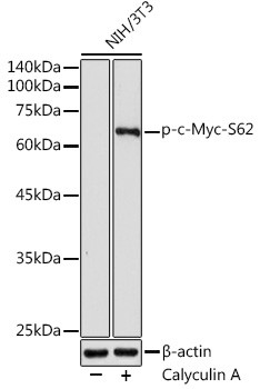 Phospho-c-Myc (Ser62) Antibody in Western Blot (WB)