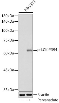 Phospho-LCK (Tyr394) Antibody in Western Blot (WB)