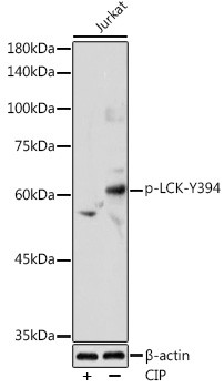 Phospho-LCK (Tyr394) Antibody in Western Blot (WB)