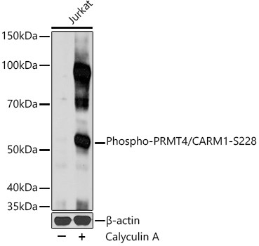 Phospho-PRMT4 (Ser228) Antibody in Western Blot (WB)