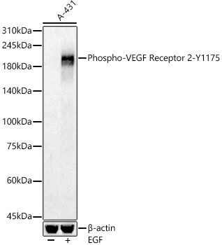 Phospho-VEGF Receptor 2 (Tyr1175) Antibody in Western Blot (WB)