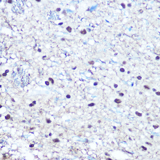 Phospho-Rb (Ser780) Antibody in Immunohistochemistry (Paraffin) (IHC (P))