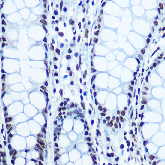 Phospho-Rb (Ser780) Antibody in Immunohistochemistry (Paraffin) (IHC (P))