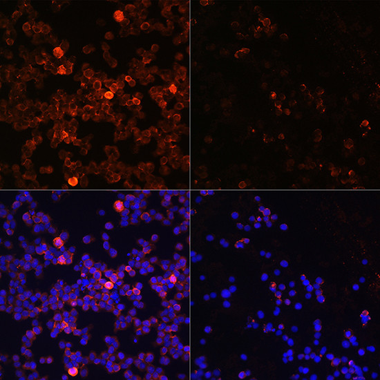 Phospho-Zap-70 (Tyr493) Antibody in Immunocytochemistry (ICC/IF)