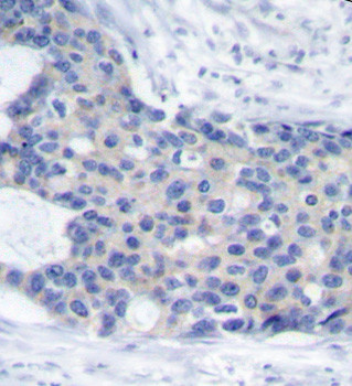 Phospho-Zap-70 (Tyr493) Antibody in Immunohistochemistry (Paraffin) (IHC (P))