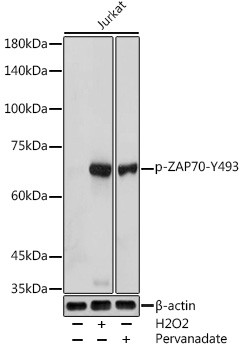 Phospho-Zap-70 (Tyr493) Antibody in Western Blot (WB)