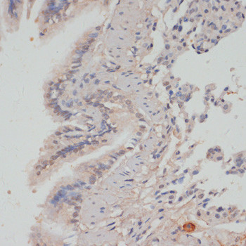 Phospho-PP1 alpha (Thr320) Antibody in Immunohistochemistry (Paraffin) (IHC (P))