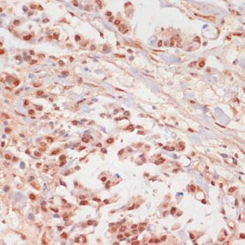 Phospho-PP1 alpha (Thr320) Antibody in Immunohistochemistry (Paraffin) (IHC (P))